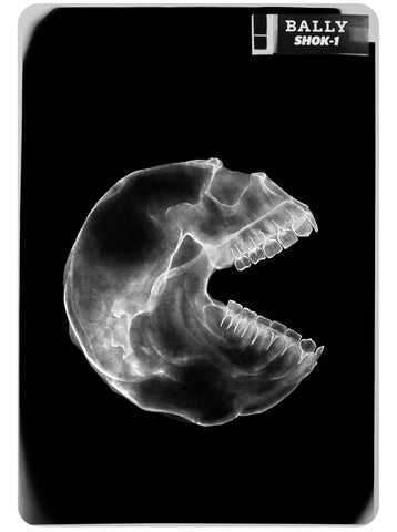 Consumer X-ray Mini print