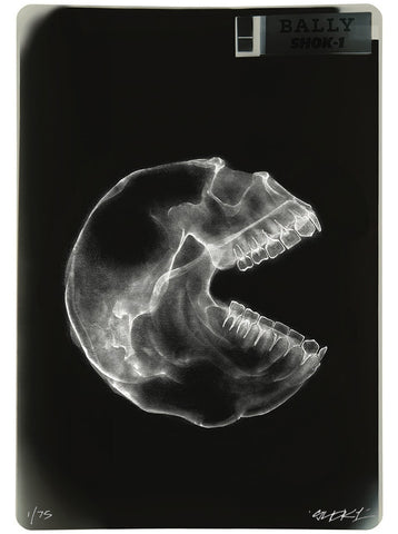 Consumer X-ray Mini print